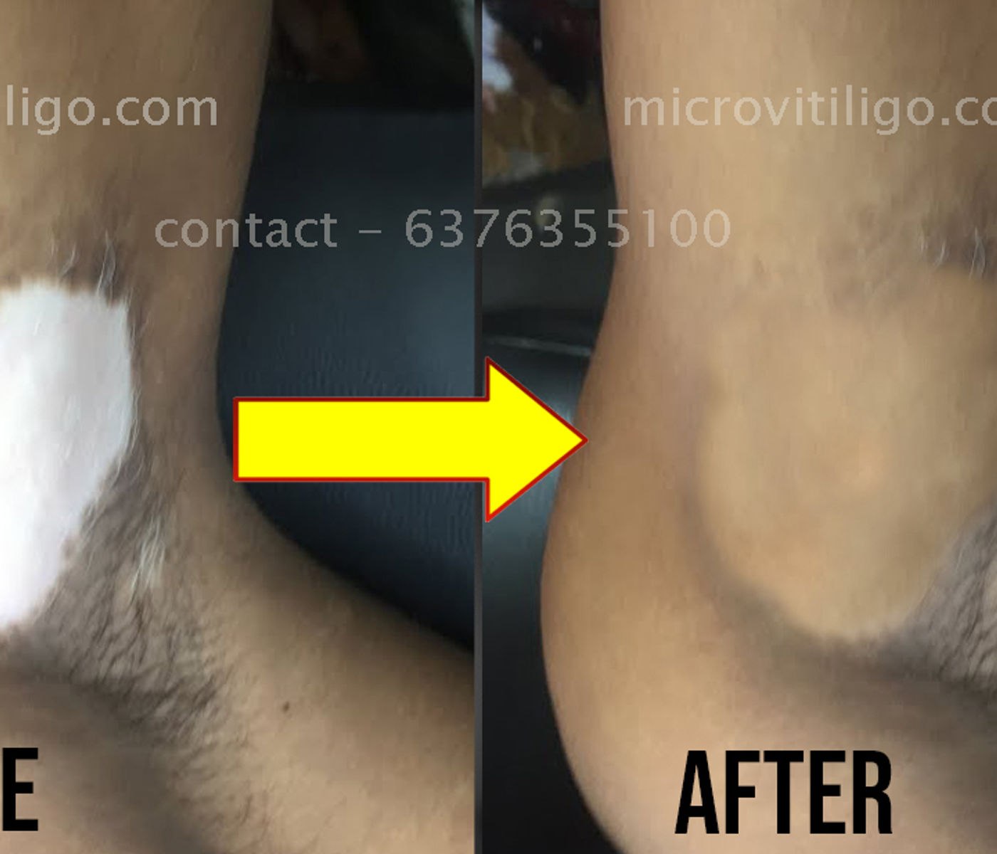 Real client result — cosmetic skin camouflage